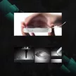 Wozinsky Samsung Galaxy Tab A 10.1. (2019) T510/515 kijelzővédő edzett üvegfólia (tempered glass) 9H keménységű